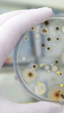 Colonies de bactéries et moisissures cultivées sur boîte de Pétri 